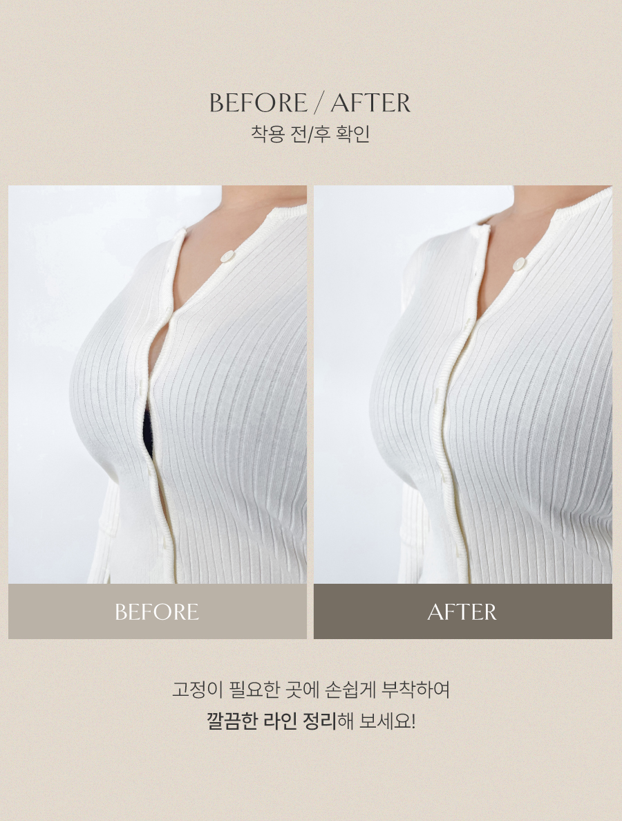 グルニー服固定テープ